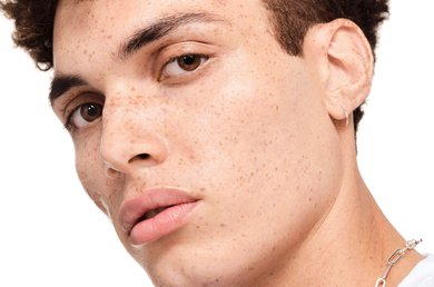 acne-y-estres-consejos-para-mantener-la-calma-y-tomar-el-control