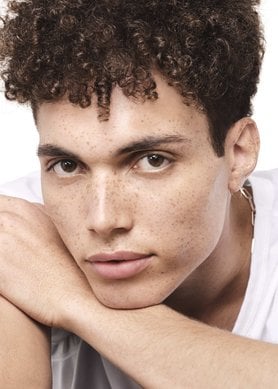 acne-invernal-como-tratar-la-piel-seca-propensa-a-las-imperfecciones