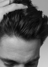 todo-lo-que-necesitas-saber-sobre-la-caspa-adherente